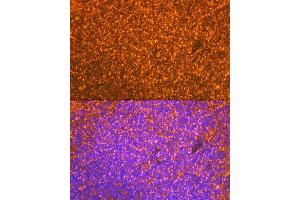 Immunofluorescence analysis of mouse spleen cells using EBI3 Rabbit mAb (ABIN7268011) at dilution of 1:100 (40x lens). (EBI3 antibody)