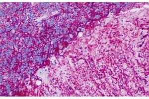 Human Brain, Cerebellum: Formalin-Fixed, Paraffin-Embedded (FFPE)