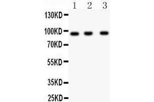 Western Blotting (WB) image for anti-Neural Precursor Cell Expressed, Developmentally Down-Regulated 9 (NEDD9) (AA 273-421) antibody (ABIN3043271) (NEDD9 antibody  (AA 273-421))