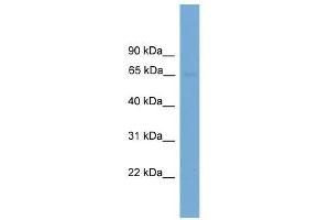 IL1RL2 antibody used at 0. (IL1RL2 antibody  (N-Term))