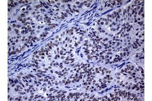 Image no. 3 for anti-Nibrin (NBN) (AA 183-460) antibody (ABIN1491067) (Nibrin antibody  (AA 183-460))