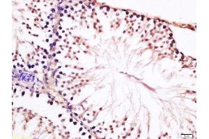 Formalin-fixed and paraffin embedded rat testis labeled with Anti-CT45A Polyclonal Antibody, Unconjugated  at 1:200 followed by conjugation to the secondary antibody and DAB staining (CT45A1 antibody  (AA 21-120))