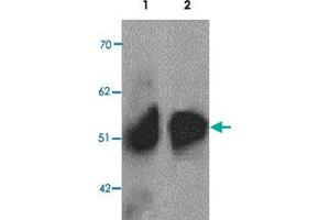 Western blot analysis of ZIP8 in human spleen tissue lysate with SLC39A8 polyclonal antibody  at 1 ug/mL (lane 1) and 2 ug/mL (lane 2). (SLC39A8 antibody  (C-Term))