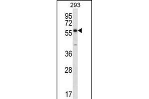 PNPLA1 Antibody (N-term) (ABIN657271 and ABIN2846363) western blot analysis in 293 cell line lysates (35 μg/lane). (PNPLA1 antibody  (N-Term))