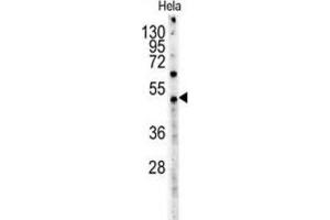 Western Blotting (WB) image for anti-Myc Tag antibody (ABIN3004426) (Myc Tag antibody)