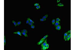 Immunofluorescent analysis of HepG2 cells using ABIN7153869 at dilution of 1:100 and Alexa Fluor 488-congugated AffiniPure Goat Anti-Rabbit IgG(H+L) (Glucagon Receptor antibody  (AA 26-136))