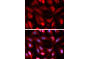 Immunofluorescence analysis of U2OS cells using SMAD4 antibody. (SMAD4 antibody  (AA 160-450))