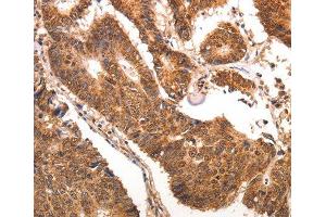 Immunohistochemistry (IHC) image for anti-Chemokine (C-C Motif) Ligand 17 (CCL17) antibody (ABIN1679017) (CCL17 antibody)