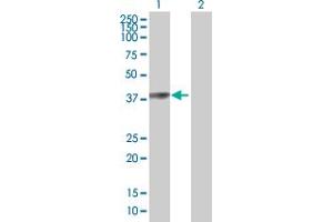 Western Blot analysis of PARK2 expression in transfected 293T cell line by PARK2 MaxPab polyclonal antibody. (Parkin antibody  (AA 1-387))