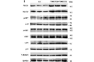 PSMD1 and PSMD2 regulate the expression level of fatty acids (FAs) and lipid synthesis-related genes.