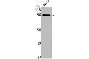 Western Blot analysis of HuvEc cells using Cadherin-16 Polyclonal Antibody (Cadherin-16 antibody  (C-Term))
