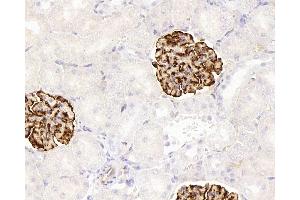 Immunohistochemistry analysis of paraffin-embedded rat kidney using NES Monoclonal Antibody at dilution of 1:400. (Nestin antibody)