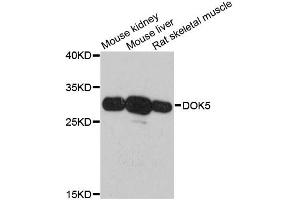 Western blot analysis of extracts of various cell lines, using DOK5 antibody. (DOK5 antibody)