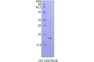 SDS-PAGE of Protein Standard from the Kit (Highly purified E. (QSOX1 ELISA Kit)