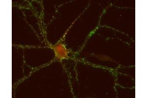 Immunocytochemistry (ICC) image for anti-gamma-aminobutyric Acid (GABA) A Receptor, Subunit beta 1 (GABRB1) antibody (ABIN2690509)