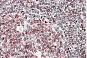 ABIN5539722 (5µg/ml) staining of paraffin embedded Human Tonsil. (FUBP1 antibody  (AA 160-174))