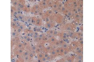 IHC-P analysis of liver tissue, with DAB staining. (Phospholipase C delta 3 antibody  (AA 528-789))