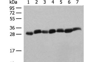 Western blot analysis of Hela cell Mouse spleen tissue Mouse liver tissue PC3 cell HL60 cell A549 cell NIH/3T3 cell lysates using PSMA3 Polyclonal Antibody at dilution of 1:350