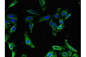 Immunofluorescent analysis of Hela cells using ABIN7159774 at dilution of 1:100 and Alexa Fluor 488-congugated AffiniPure Goat Anti-Rabbit IgG(H+L) (MAP1LC3B2 antibody  (AA 1-47))