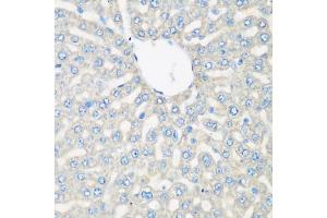 Immunohistochemistry of paraffin-embedded rat liver using C3 antibody (ABIN5975433) at dilution of 1/200 (40x lens).