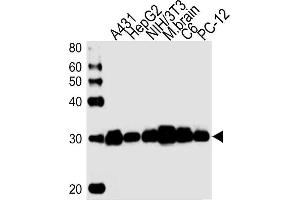 Lane 1: A431 Cell lysates, Lane 2: HepG2 Cell lysates, Lane 3: NIH/3T3 Cell lysates, Lane 4: mouse brain lysates, Lane 5: C6 Cell lysates, Lane 6: PC-12 Cell lysates, probed with YWHAZ (1314CT423. (14-3-3 zeta antibody)