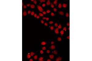 ABIN6267372 staining LOVO by IF/ICC. (SRF antibody  (pSer99))