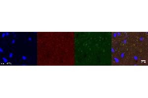 Immunohistochemistry (IHC) image for anti-Discs, Large Homolog 4 (Drosophila) (DLG4) antibody (ABIN7455965)