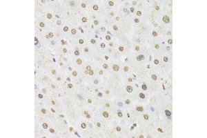 Immunohistochemistry (Paraffin-embedded Sections) (IHC (p)) image for anti-Heterogeneous Nuclear Ribonucleoprotein D (HNRNPD) (AA 1-306) antibody (ABIN6141905)