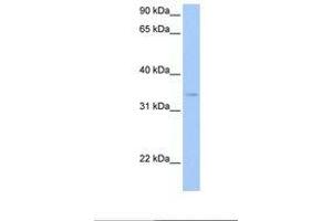 Image no. 1 for anti-Pyridoxal Kinase (PDXK) (AA 27-76) antibody (ABIN6738866) (PDXK antibody  (AA 27-76))