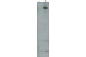 RK8 (LRRK2) Antibody  h detect over-expressed human LRRK2 protein. (LRRK2 antibody  (AA 930-961))
