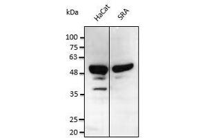 Anti. (p53 antibody  (C-Term))