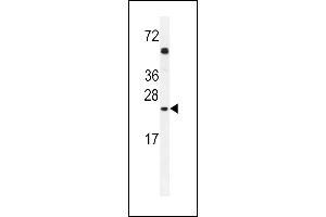 GOLGA2L1 Antibody (C-term) (ABIN654533 and ABIN2844251) western blot analysis in A549 cell line lysates (35 μg/lane). (GOLGA2P5 antibody  (C-Term))