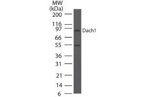 Image no. 2 for anti-Dachshund 1 (DACH1) (AA 474-491) antibody (ABIN960126) (DACH1 antibody  (AA 474-491))