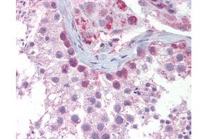 Anti-SYCP3 antibody IHC of human testis. (SYCP3 antibody  (N-Term))