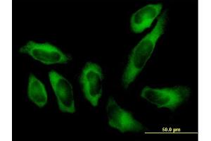 Immunofluorescence of purified MaxPab antibody to AARS on HeLa cell. (AARS antibody  (AA 1-968))