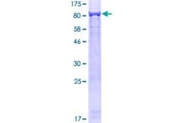 Seryl-tRNA Synthetase (SARS) (AA 1-514) protein (GST tag)