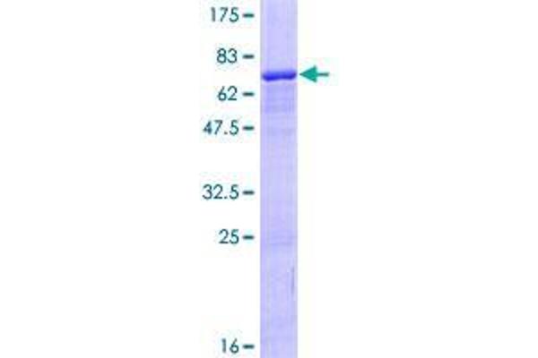 ZNF584 Protein (AA 1-421) (GST tag)