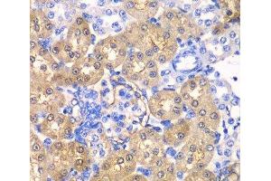Immunohistochemistry of paraffin-embedded Rat kidney using HPD Polyclonal Antibody at dilution of 1:100 (40x lens). (HPD antibody)