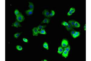 Immunofluorescent analysis of A431 cells using ABIN7175216 at dilution of 1:100 and Alexa Fluor 488-congugated AffiniPure Goat Anti-Rabbit IgG(H+L) (ATP6VA2 (AA 476-549), (Isoform 2) antibody)