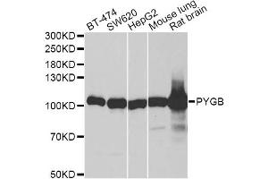 Western blot analysis of extracts of various cell lines, using PYGB antibody (ABIN6293330) at 1:1000 dilution.