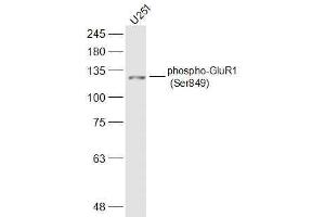 U251 lysates probed with phospho-GluR1 (Ser849) Polyclonal Antibody, Unconjugated  at 1:500 dilution and 4˚C overnight incubation. (Glutamate Receptor 1 antibody  (pSer849))