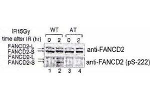 Indicated lymphoblasts (PD7, WT : GM1526, AT) were irradiated with 15 Gy (2), and immunoblotted with anti-FANCD2 and FANCD2 (phospho S222) polyclonal antibody .