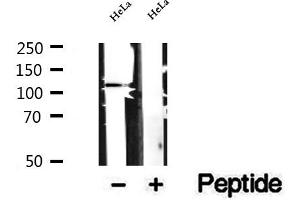 Western blot analysis of extracts of HeLa cells, using DAAM1 antibody. (DAAM1 antibody  (Internal Region))