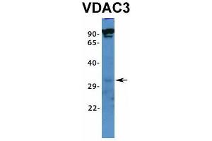 Host:  Rabbit  Target Name:  VDAC3  Sample Type:  RPMI-8226  Antibody Dilution:  1. (VDAC3 antibody  (N-Term))