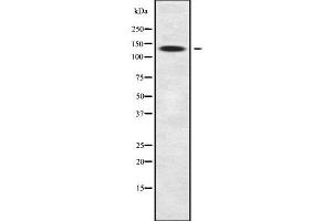 Western blot analysis SLC9A11 using COS7 whole cell lysates (SLC9C2/SLC9A11 antibody)