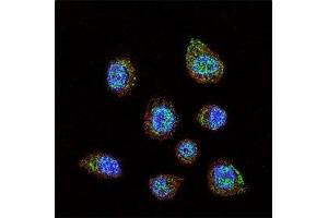 Confocal immunofluorescent analysis of HIF-1 alpha antibody with MDA-MB231 cells followed by Alexa Fluor 488-conjugated goat anti-rabbit lgG (green). (HIF1A antibody  (AA 728-757))