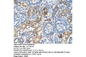 Rabbit Anti-HNRPL Antibody  Paraffin Embedded Tissue: Human Kidney Cellular Data: Epithelial cells of renal tubule Antibody Concentration: 4. (HNRNPL antibody  (N-Term))