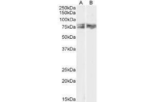 Western Blotting (WB) image for anti-LIM Domain Kinase 2 (LIMK2) (AA 181-193) antibody (ABIN5870577) (LIMK2 antibody  (AA 181-193))