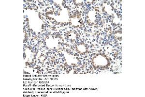 Human Lung (ZNF195 antibody  (N-Term))