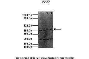 Lanes:   Lane1: 20ug RH30 lysate Lane2: 20ug RH30 lysate Lane3: 20ug RH41 lysate Lane4: 20ug RH41 lysate  Primary Antibody Dilution:   1:1000  Secondary Antibody:    Donkey anti-rabbit HRP  Secondary Antibody Dilution:   1:4000  Gene Name:   PAX3  Submitted by:   Dr Joanna Selfe, Institute of Cancer Research (Paired Box 3 antibody  (N-Term))